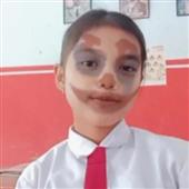 Tỷ