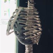 ti