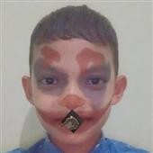 Tr