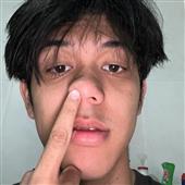 Rắn 