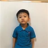 Mắt 