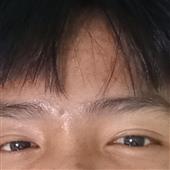 Tr