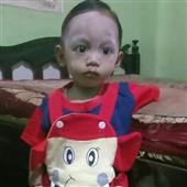 Pl