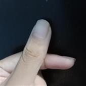 Mẹo 