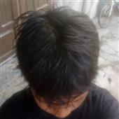 Nổ